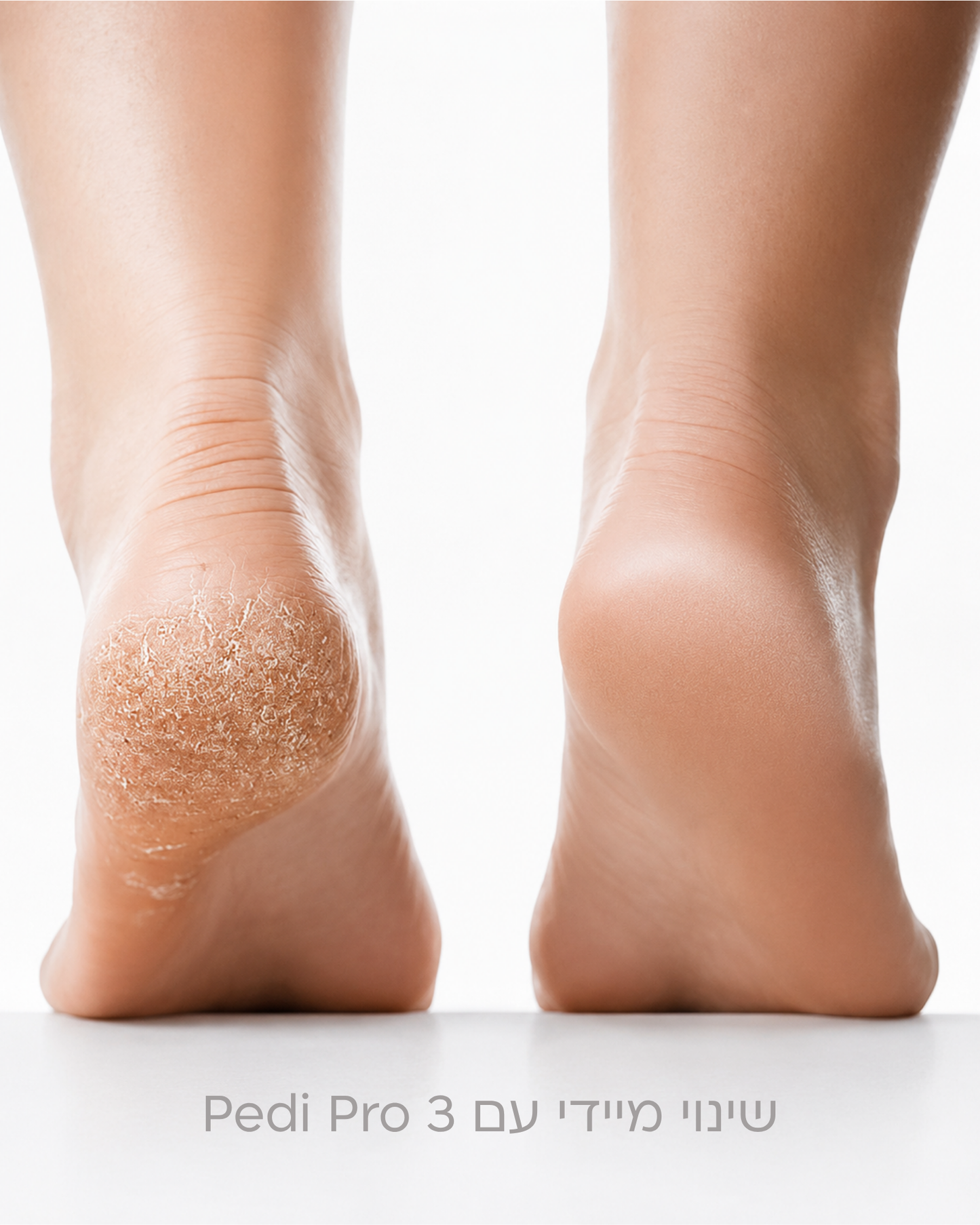 PediPro™ 3