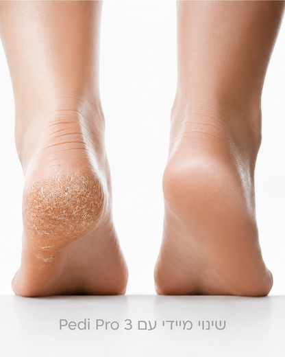 PediPro™ 3